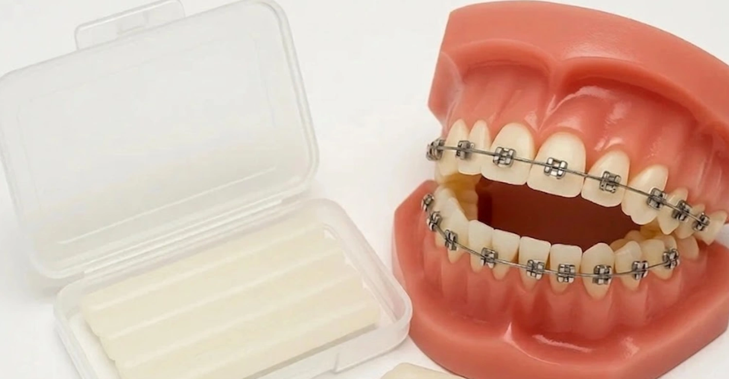 can i sleep with orthodontic wax inblog